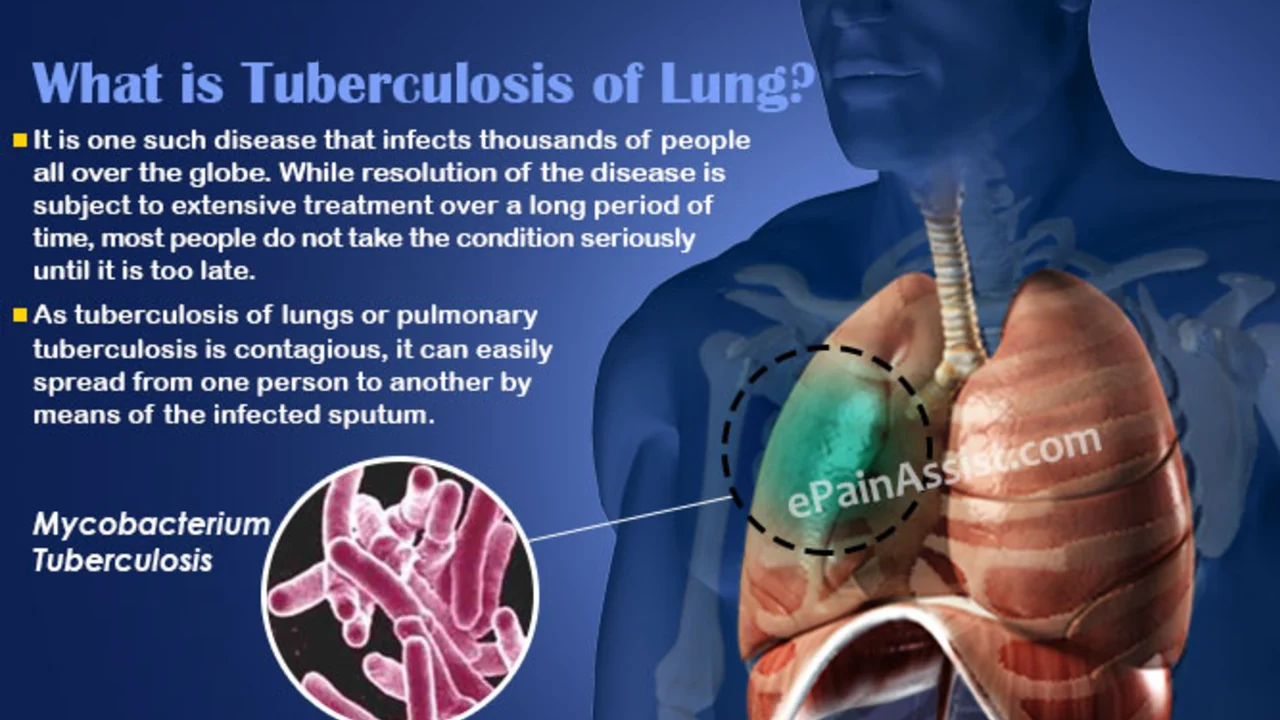 Drug-Resistant Tuberculosis: A Growing Global Concern